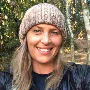 Biodentex user - Jennifer Collins